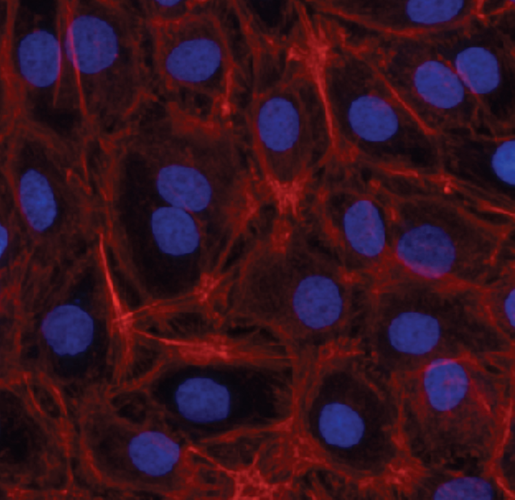 Study Design of In Vitro Skin Sensitization - ARE-Nrf2 Luciferase Test Method [KeratinoSens] (OECD 442D)
