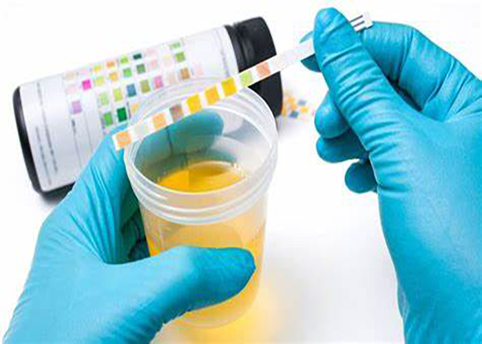 Unmasking the Hidden Danger: Why Toxicological Testing Stands Guard for Medical Devices