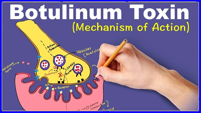 Blog - Laboratory Testing & Analysis 3 Botulinum Toxin and Botulinum Toxin Testing
